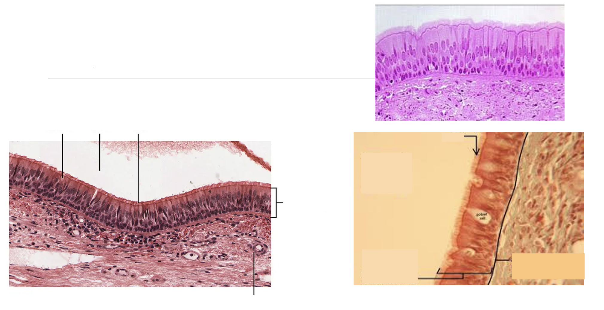 <p>What type of epithelial tissue?</p>