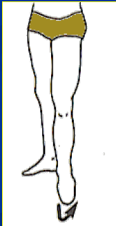 <p>What Movement is occurring?</p>