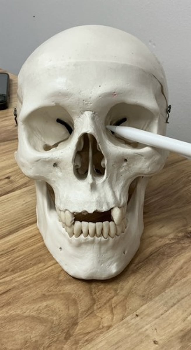 <p>What bone is this?</p>