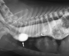 <p>What is this condition called? It causes the regurgitation of food</p>