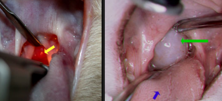 <p><span>Nasopharyngeal Polyps</span></p>