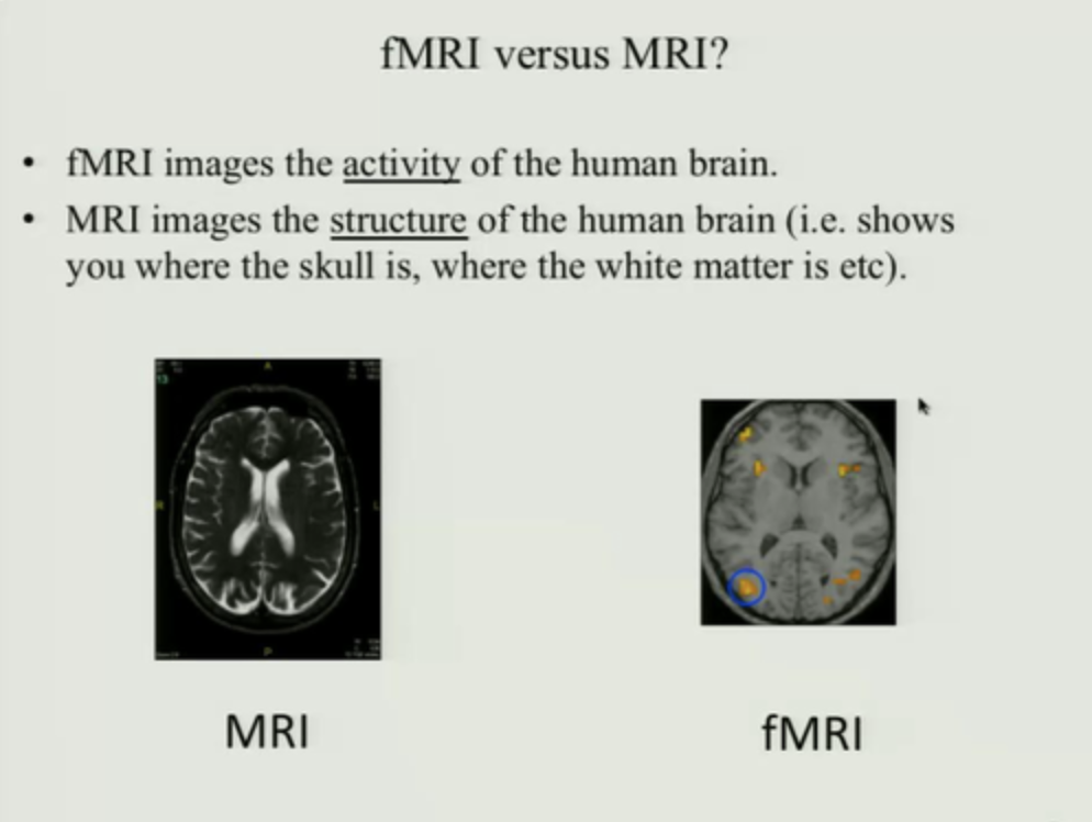 fMRI (functional MRI) disadvantages

\-functional indirect
