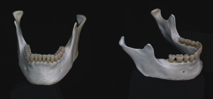 name the bone 