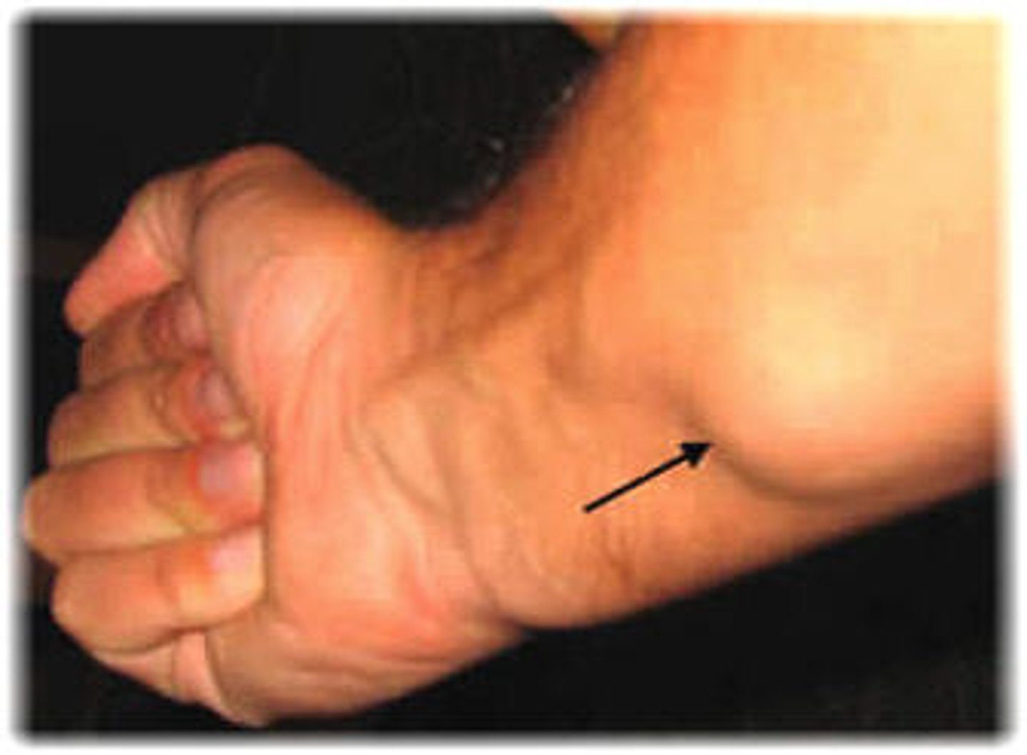 <p>diagnose this:</p><p>Well circumscribed, benign adipose tissue</p>