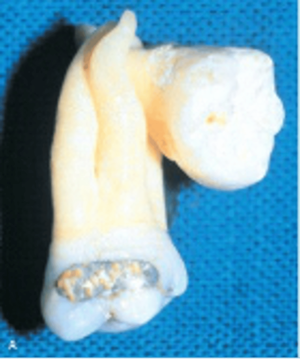 <p>Concrescence</p>