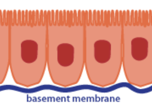 <p>Base-ment mem-brane</p>