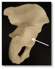 Name this specific part of the pelvic bone.