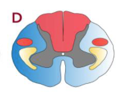 <p>Describe the effects of the lesion</p>