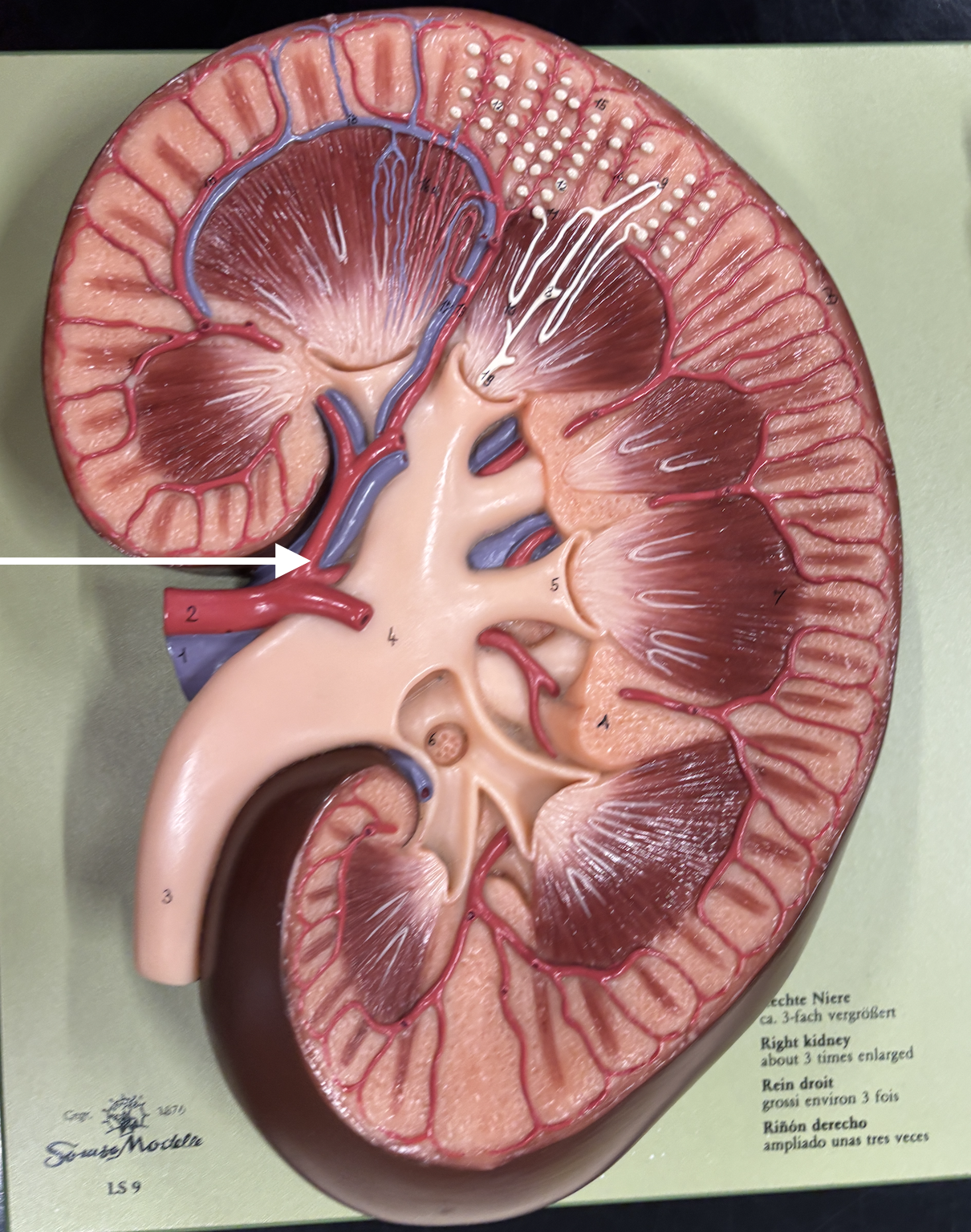 <p>what structure is the arrow pointing to? *artery*</p>
