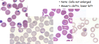 <p>What is the genus, species, and stage of this parasite?</p>