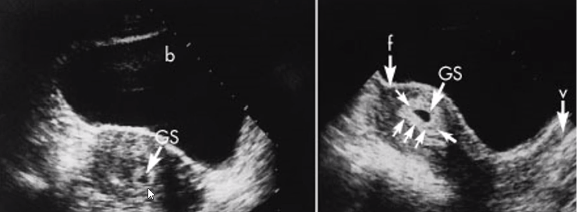 <p>identify decidua in this photo!</p>