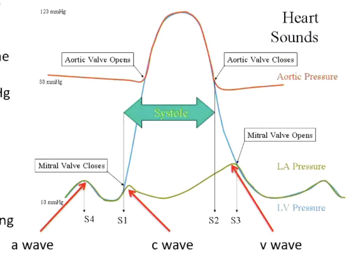 <p>ventricular systole begins when the mitral valve closes and ends when the aortic valve closes</p>