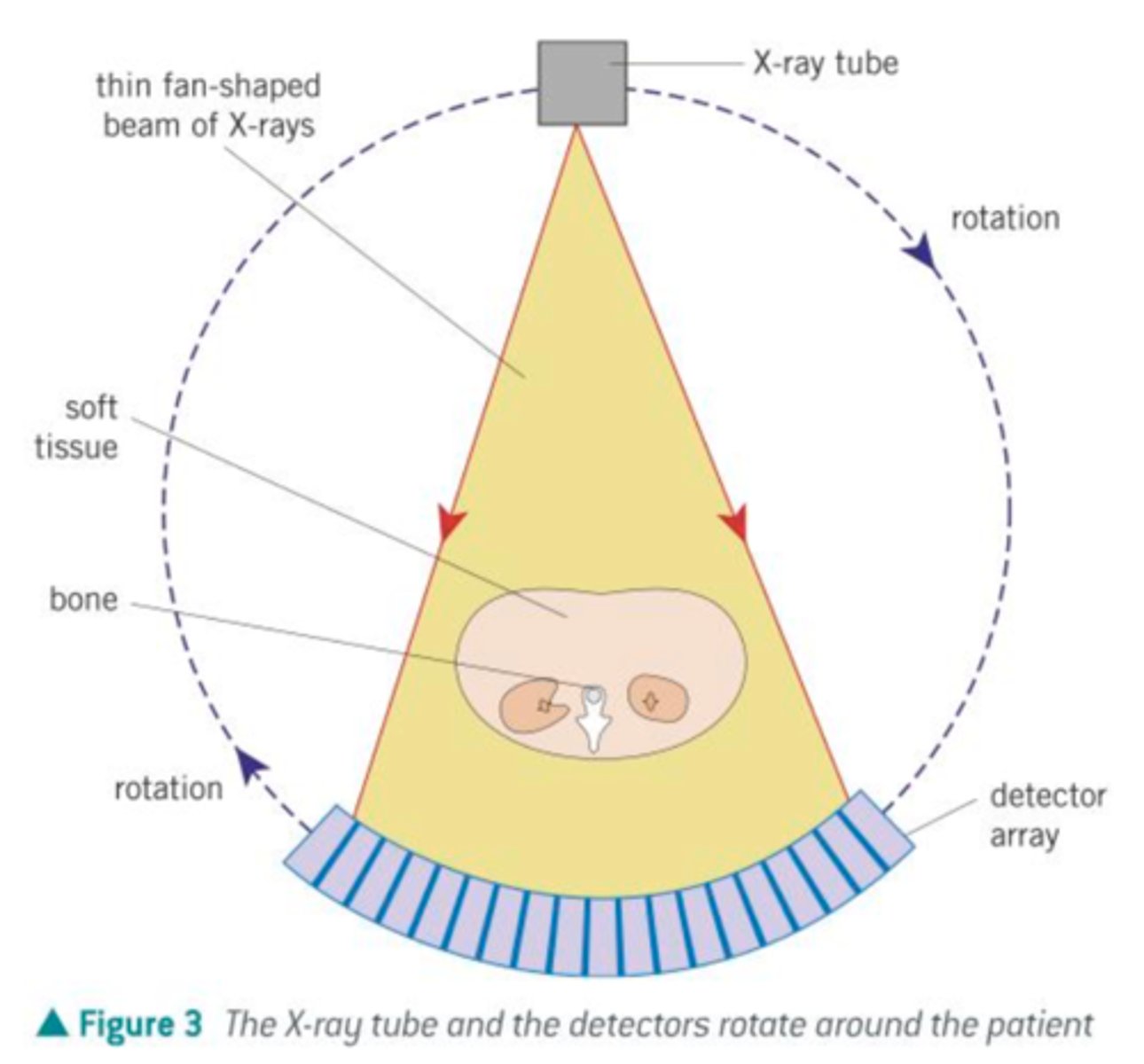 <p>- X-ray tube generates a fan-shaped beam of X-rays typically 1-10 mm thick</p><p>- thin beam irradiates a thin slice of the patient</p><p>- x-rays are attenuated by different amounts by different tissues</p><p>- the intensity of the transmitted X-ray is recorded by detectors which send electrical signals to a computer</p><p>- each time a full rotation occurs, a 2d image is produced</p><p>- x-ray tubes and detectors rotate about the patient and move up and down their length</p><p>- each 2d image can be compiled into a 3d image</p>