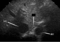 <p>What is the name of the structure crossed out? </p>