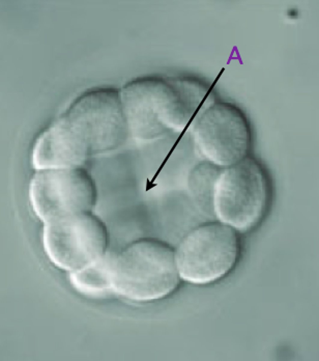 <p>During cleavage: the fluid-filled cavity within the blastula</p>