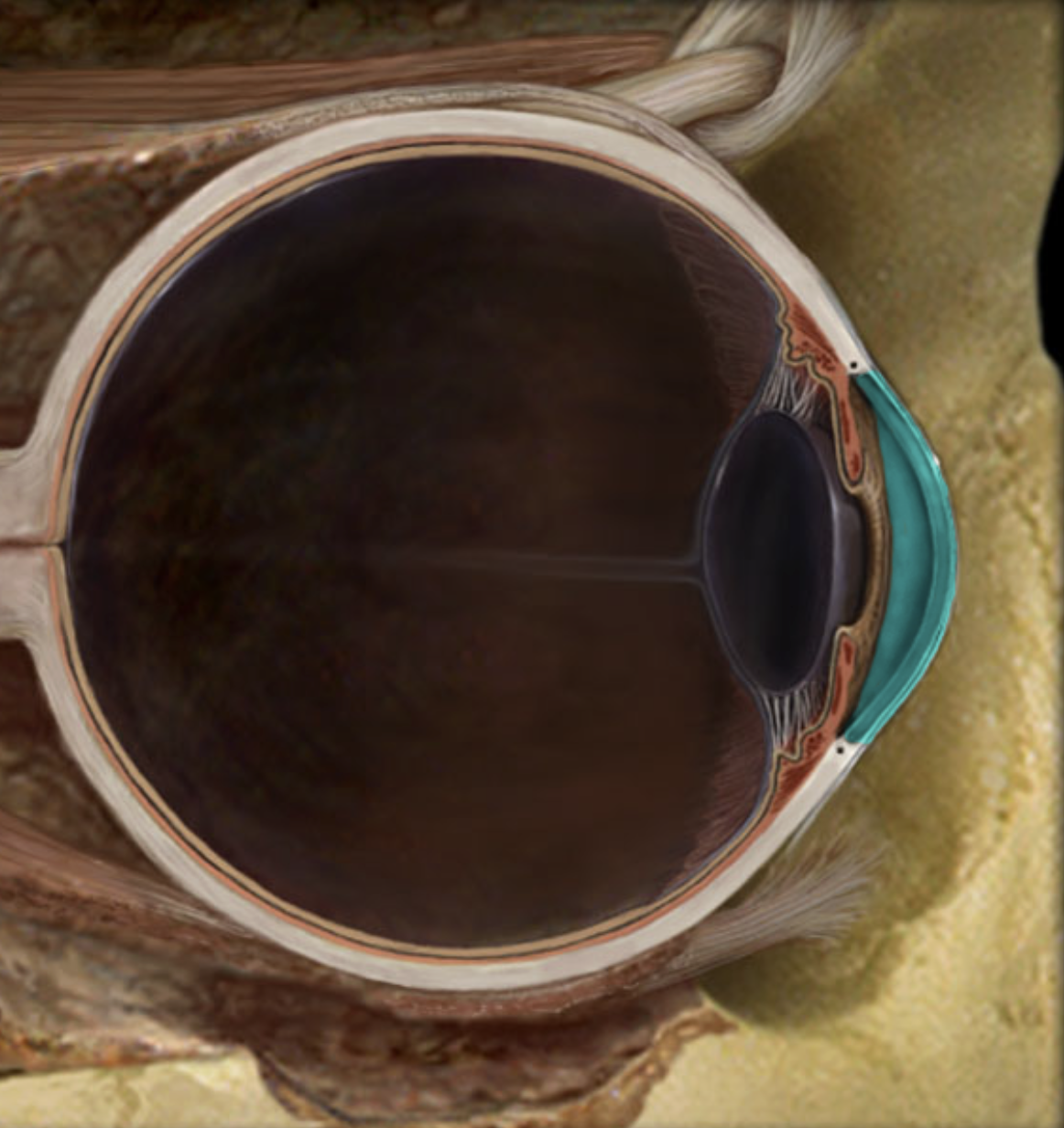 term image