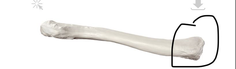 <p>Welk deel van de clavicula is dit? (Links is mediaal)</p>