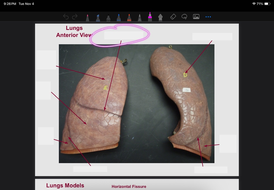 <p>What is this?</p>