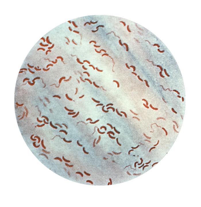Vibrio cholerae