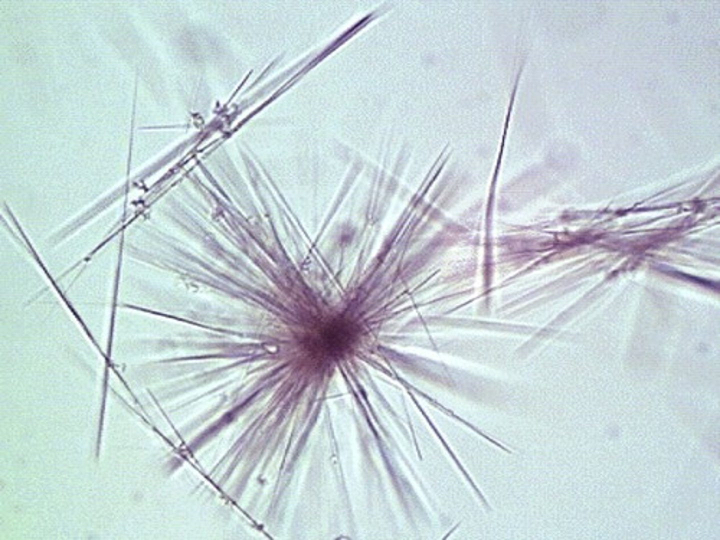 <p>Tyrosine Crystals</p><p>-Often seen with leucine</p>