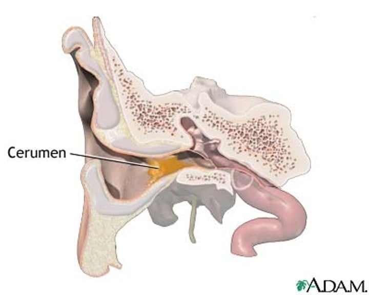 <p>modified sweat glands, located in external ear canal, secretes cerumen (earwax) to protect ear from dehydration</p>