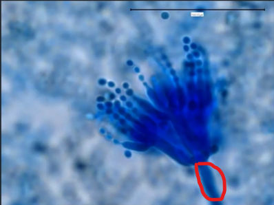 <p>Which fungus is this?</p>