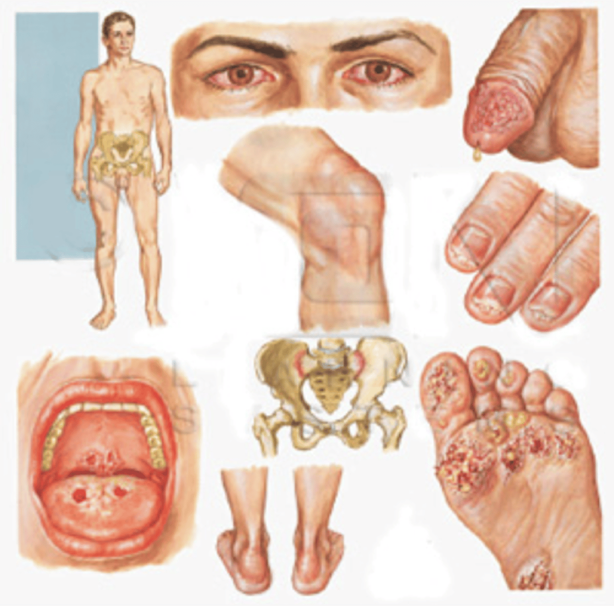 <p>genitals, palms, soles</p>