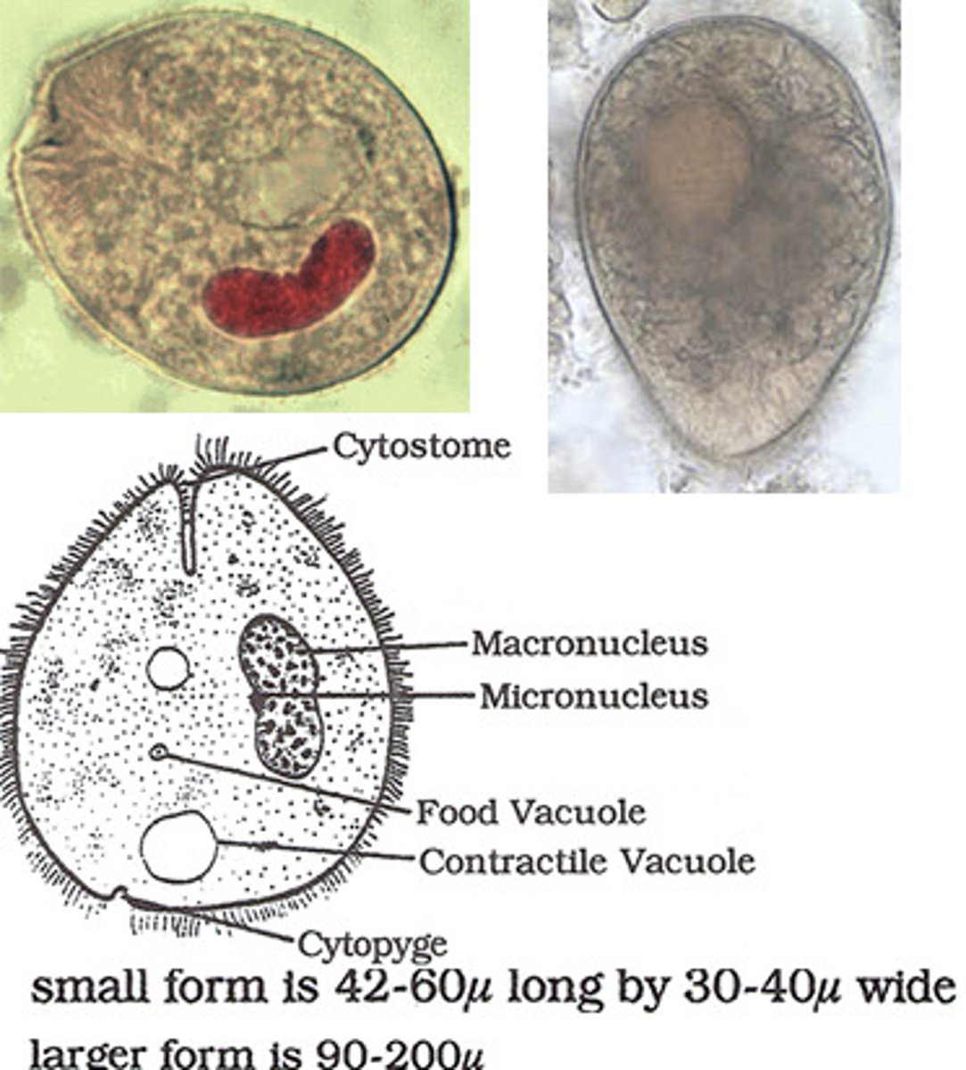 <p>This ciliate is considered the largest intestinal protozoan to parasitize humans. The large-kidney shaped macronucleus and cytostome aid in the identification of this trophozoite, which is ___ in trichrome stain.</p>