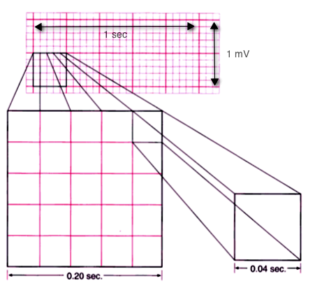 <p>Rhythm strip boxes</p>