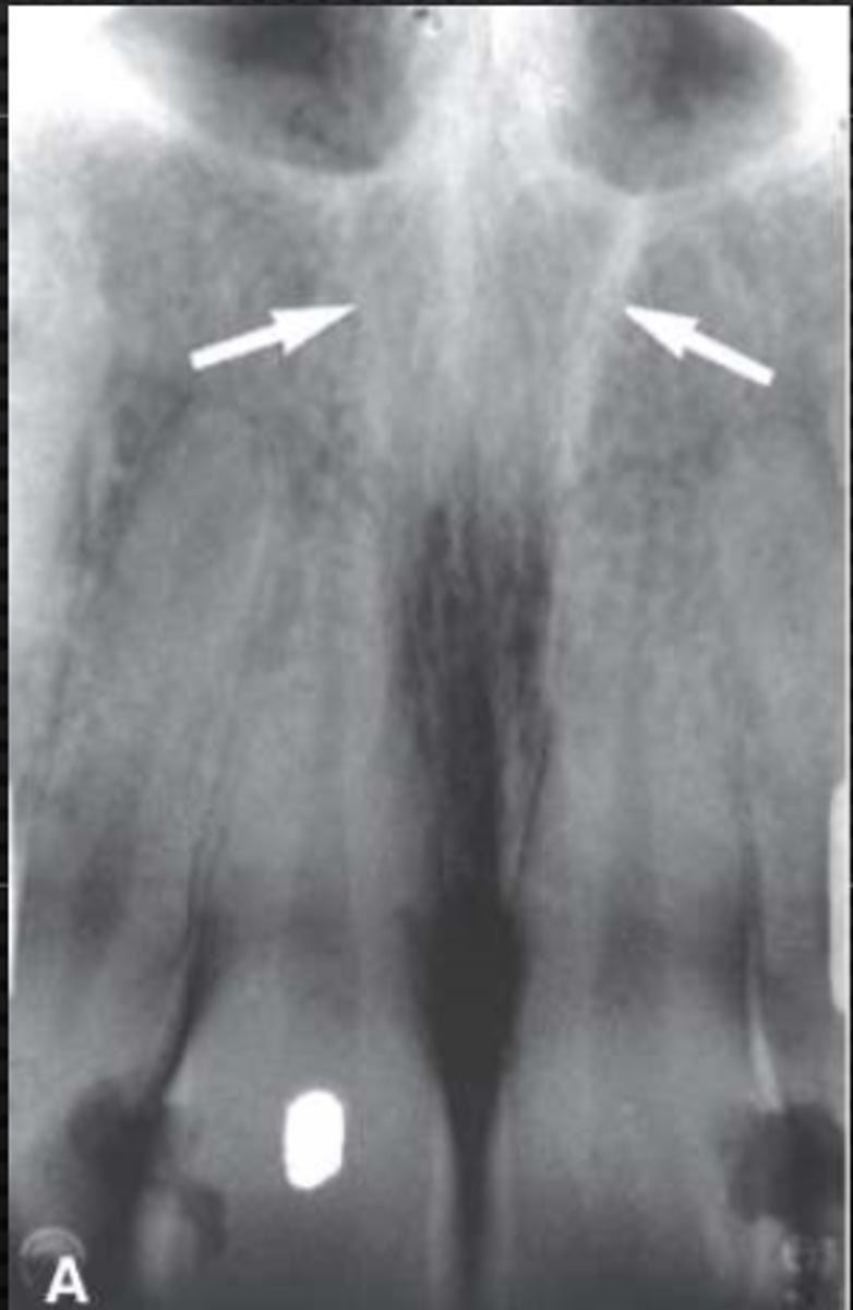 <p>Identify the structure</p>
