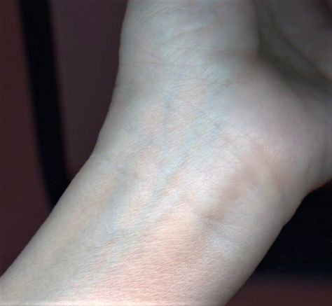 <p>wrist</p>