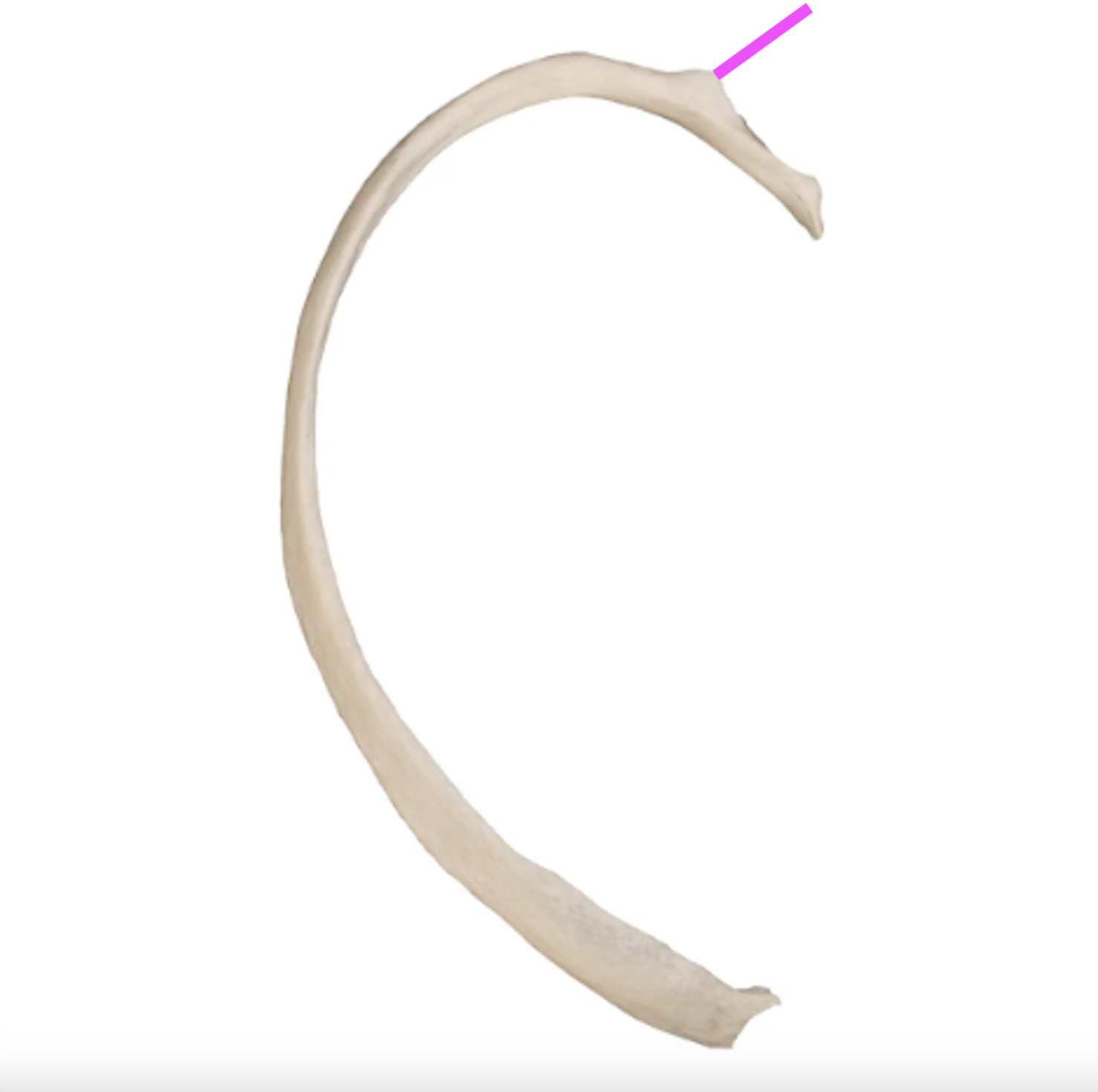 <p>What part of the rib is this?</p>