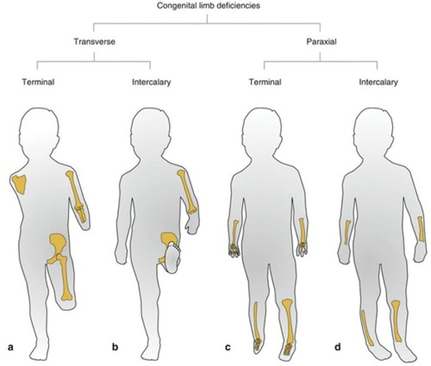 <p>Transverse terminal and transverse intercalary.</p>