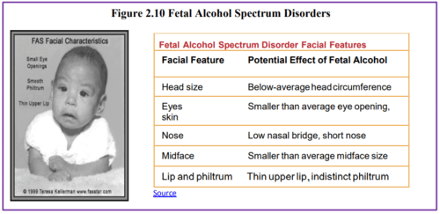 <p>an umbrella term for the range of effects that can occur due to alcohol consumption during pregnancy</p><p>NOTE:</p><p>- Fetal Alcohol Syndrome (FAS)</p><p>- Flattened noses, small eye holes, and small heads.</p><p>- Cognitively, these children have poor judgment, poor impulse control, higher rates of ADHD, learning issues, and lower IQ scores.</p>