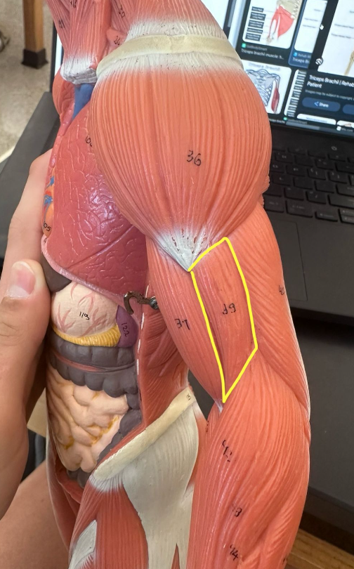 <p>What muscle is the yellow line indicating? What action does this muscle perform?</p><p>What is the origin and insertion of this muscle?</p>