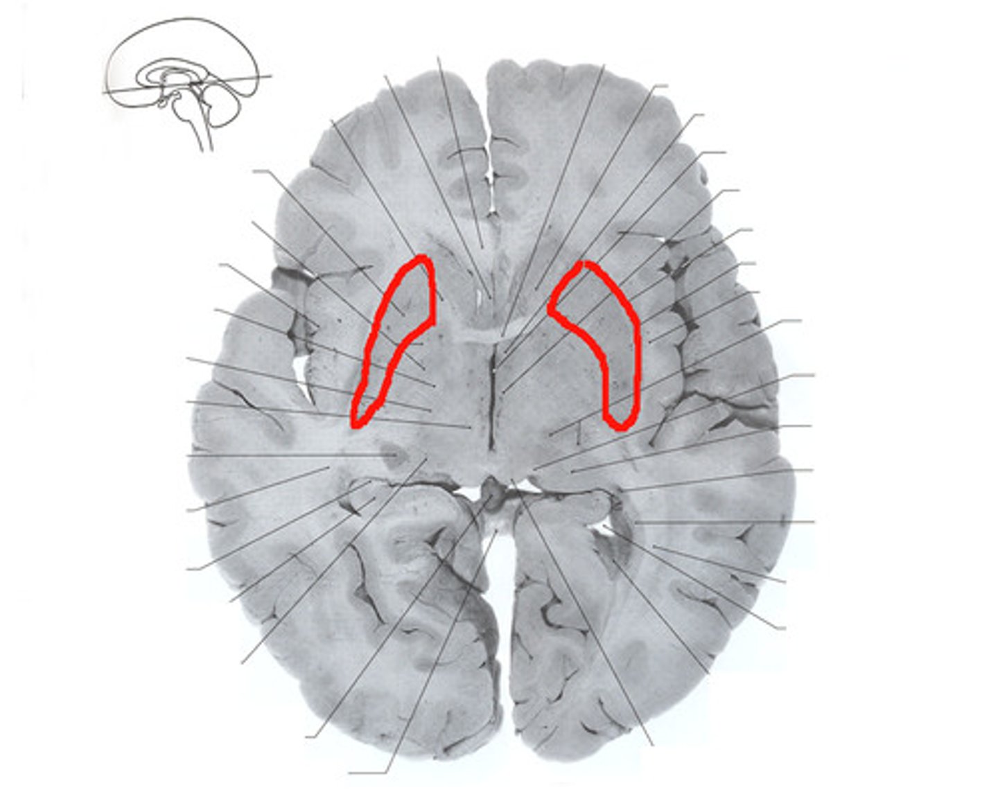 <p>large subcortical structure, part of the basal ganglia</p>