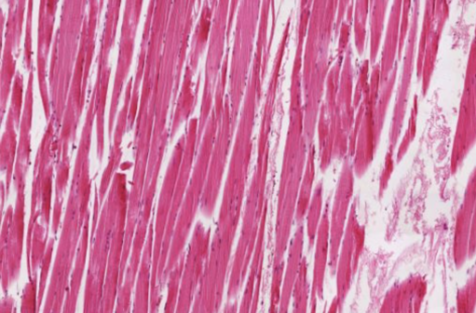<p>Muscle tissue that is long cylindrical, multinucleated, striated, and under voluntary control. It contracts to produce movement, sustains body posture and position, maintains body temperature, stores nutrients, and stabilizes joints.</p>