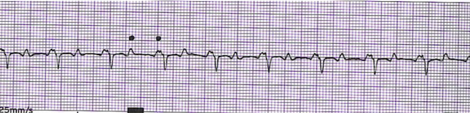 <p>What is this rhythm?</p>