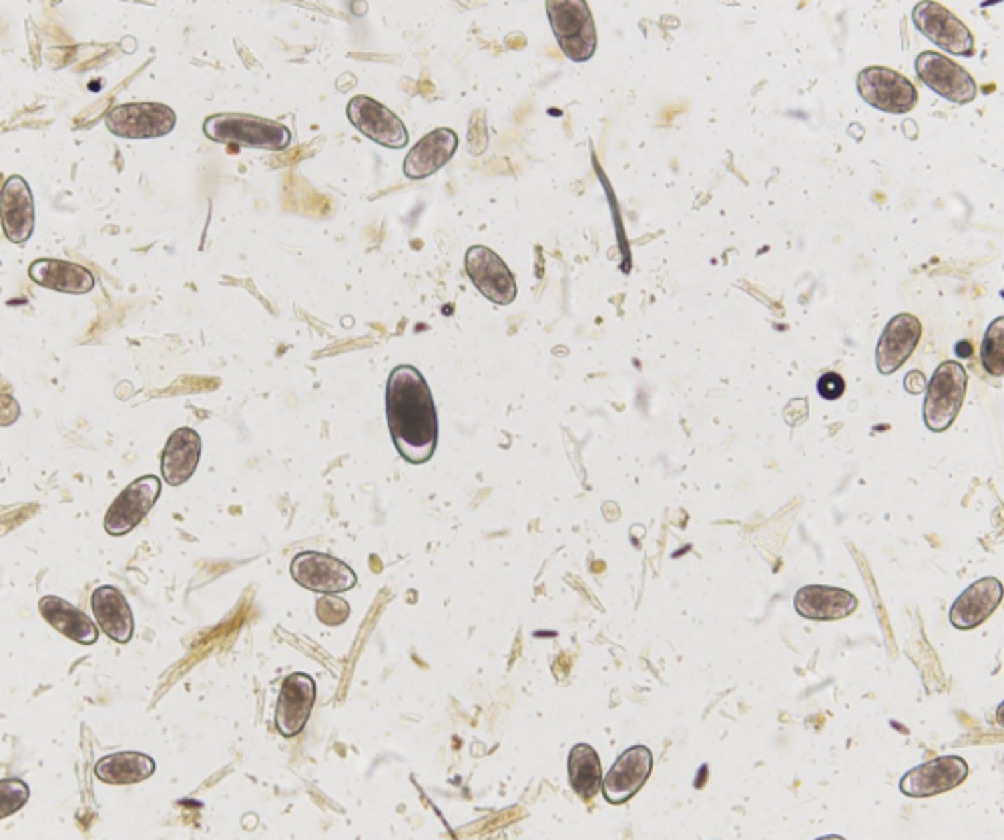 <p>Identify these thin shelled, ellipsoidal, a grey colored eggs in equine</p>