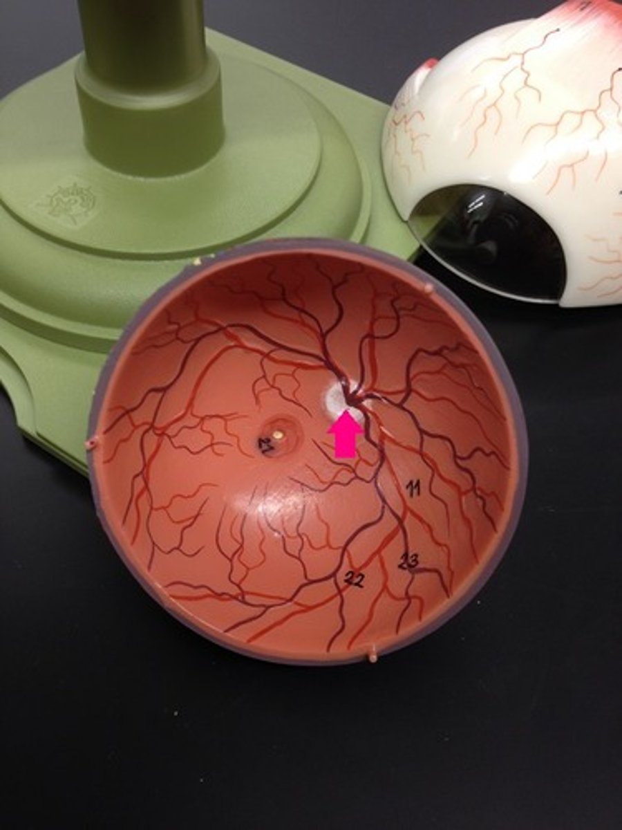 <p>Identify the white circle.</p>