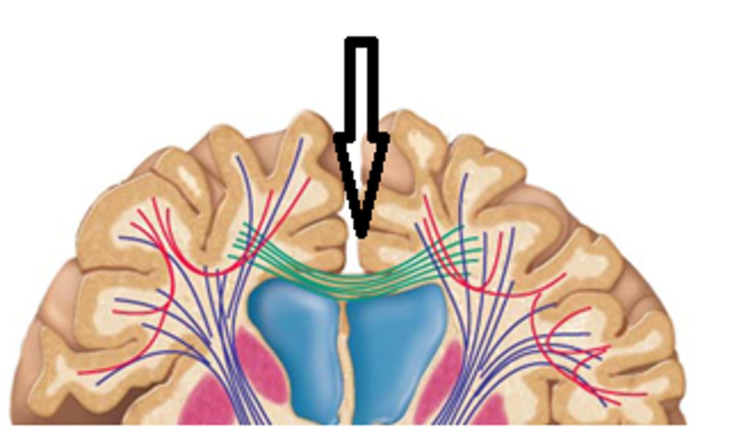 <p>- tracts that cross the midline of the brain</p><p>- corpus callosum</p><p>- anterior + posterior commissures</p>