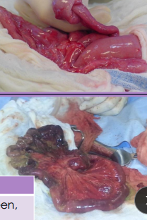 <ul><li><p><strong>Enterotomy: </strong>FB, full tickness biopsy&nbsp;</p><ul><li><p>Full exploration and isolate bowel w/ sponges</p></li><li><p><strong><u>Incise on antimesenteric surface</u></strong></p><ul><li><p><strong><u>Aborad to FB (#1) &gt; Orad to FB &gt; Over FB</u></strong></p></li></ul></li><li><p>Leak test (22g needle) and <u>wrap incision in omentum</u></p></li></ul></li></ul><ul><li><p><strong>Resection &amp; Anastomosis:</strong> resect devitalized bowl</p><ul><li><p>Isolate diseased bowel</p></li><li><p>Ligate vessels and clamp</p><ul><li><p><u>Carmalt</u> (resected side, crushing), <u>Doyen</u> (remaining side, non-crushing)</p></li></ul></li><li><p>Suture bowel, close mesenteric defect, omentalize</p></li><li><p>Can resect &lt; 70%</p></li><li><p><strong>Lavage!!! Lavage!!! Lavage !!!</strong></p></li><li><p>Fish-mouth the smaller side: mix match sizes</p></li></ul></li></ul><img src="https://knowt-user-attachments.s3.amazonaws.com/c214a5b1-febb-4a7a-a129-956a2280b7d3.png" data-width="25%" data-align="center"><img src="https://knowt-user-attachments.s3.amazonaws.com/1ce92009-62ac-4665-a1f8-979641d9b1cc.png" data-width="25%" data-align="center"><img src="https://knowt-user-attachments.s3.amazonaws.com/0a65379d-da12-49a1-a61a-49a0ef88043d.png" data-width="50%" data-align="center"><p></p>