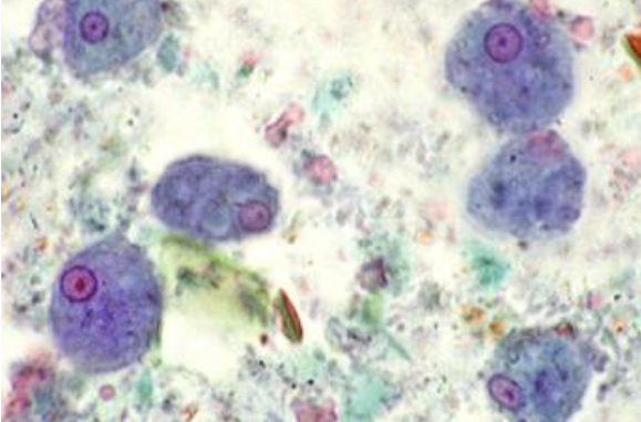 <p>entamoeba histolytica trophozoite </p>
