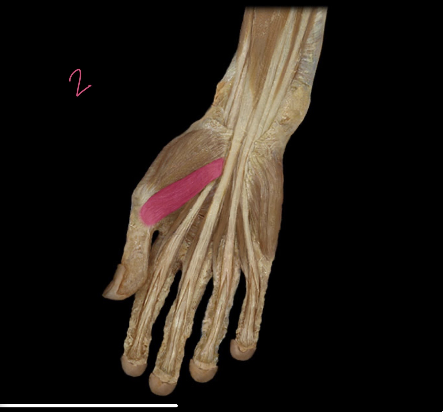 <p>Adductor brevis </p>
