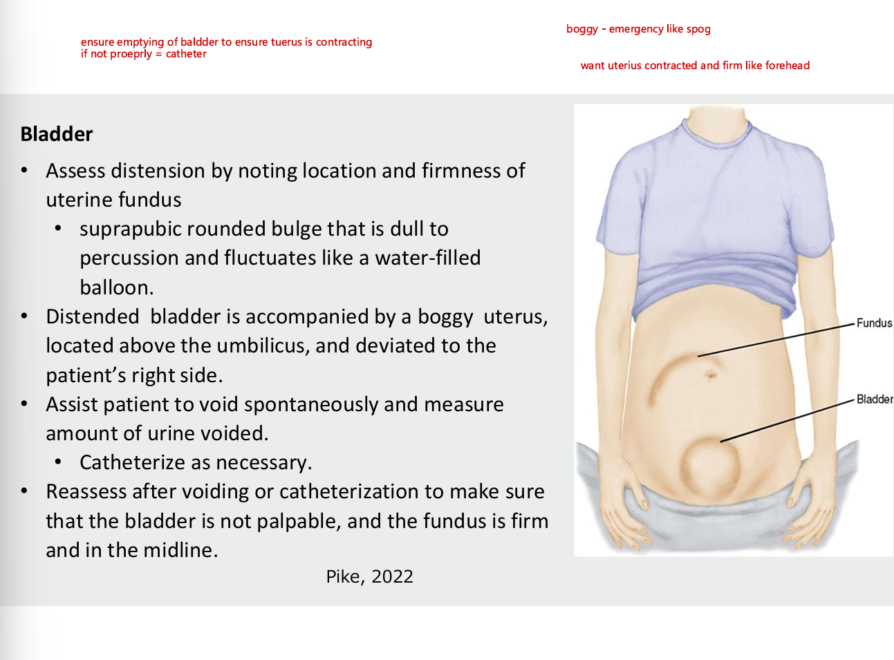 <ul><li><p>assess distension by noting location and firmness of uterine fundus</p><ul><li><p>suprapubic rounded bulge that is dull to percussion and fluctuates like water filled balloon</p></li></ul></li><li><p>distended bladder is accompanied by a boggy uterus, located above the umbilicus and deviated to the patient right side</p></li><li><p>assist patient to avoid spontaneously and measure urine voided - catheter as necessary</p></li><li><p>reassess after voiding or catherization to make sure that the bladder is not palpable and the fundus is firm in the midline</p></li></ul><p></p>