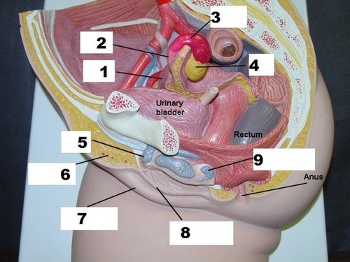 <p>(#8)</p><p>medial folds of hairless skin that surrounds the vestibule</p>