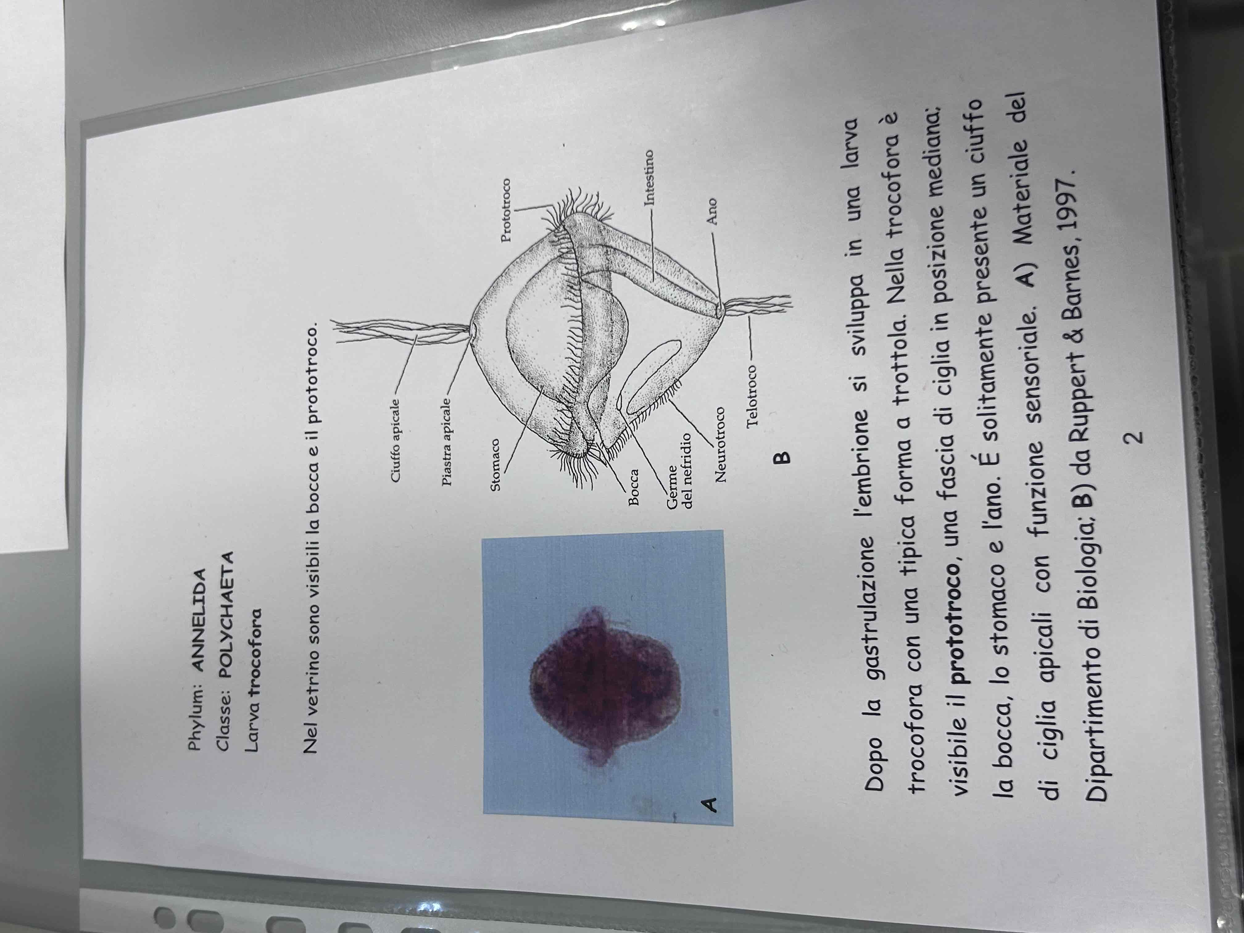 <p>Anellidi</p><p>Policheti erranti</p><p>Nereis sp (larva trocofora)</p>