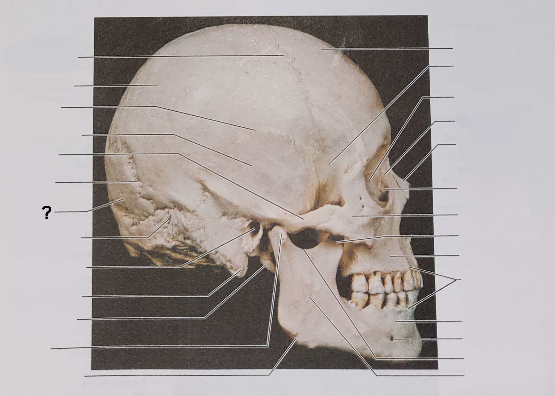 <p>Name the indicated structure</p>