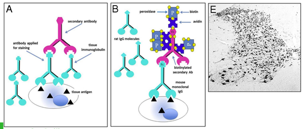   

The ABC method is a three-step detection method: the primary antibody binds to the antigen in the tissue; it is in turn recognized by the biotinylated secondary antibody; complexes formed by avidin and biotinylated enzyme (ABC) can then attach to the latter. Since the avidin tetramer can bind four biotinylated biotins, large ABC lattices containing several reporter enzymes are formed, leading to a strong amplification of the signal at the antigenic site.

 

* Amplification of weak signals, one avidin molecule can bind to multiple biotin molecuels
* Higher dilution of primary antibody (higher specificity) 

  