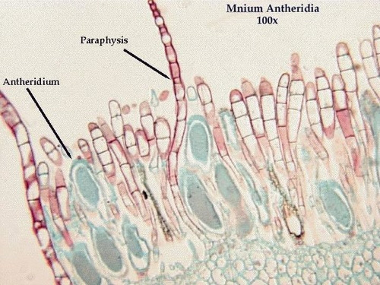 <p>sterile hyphae in fruiting body of fungi</p>